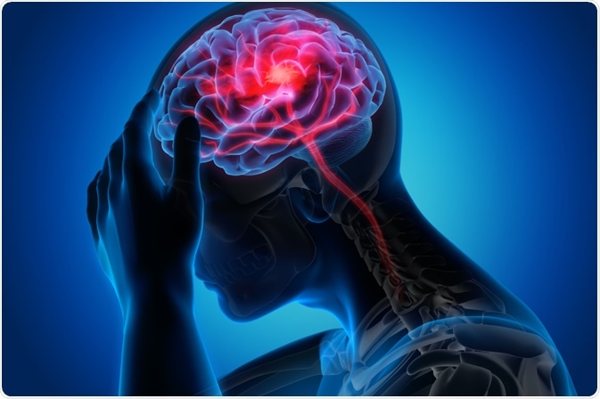 Traumatic Brain Injury: Top Signs to Observe
